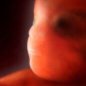 8 weeks pregnant